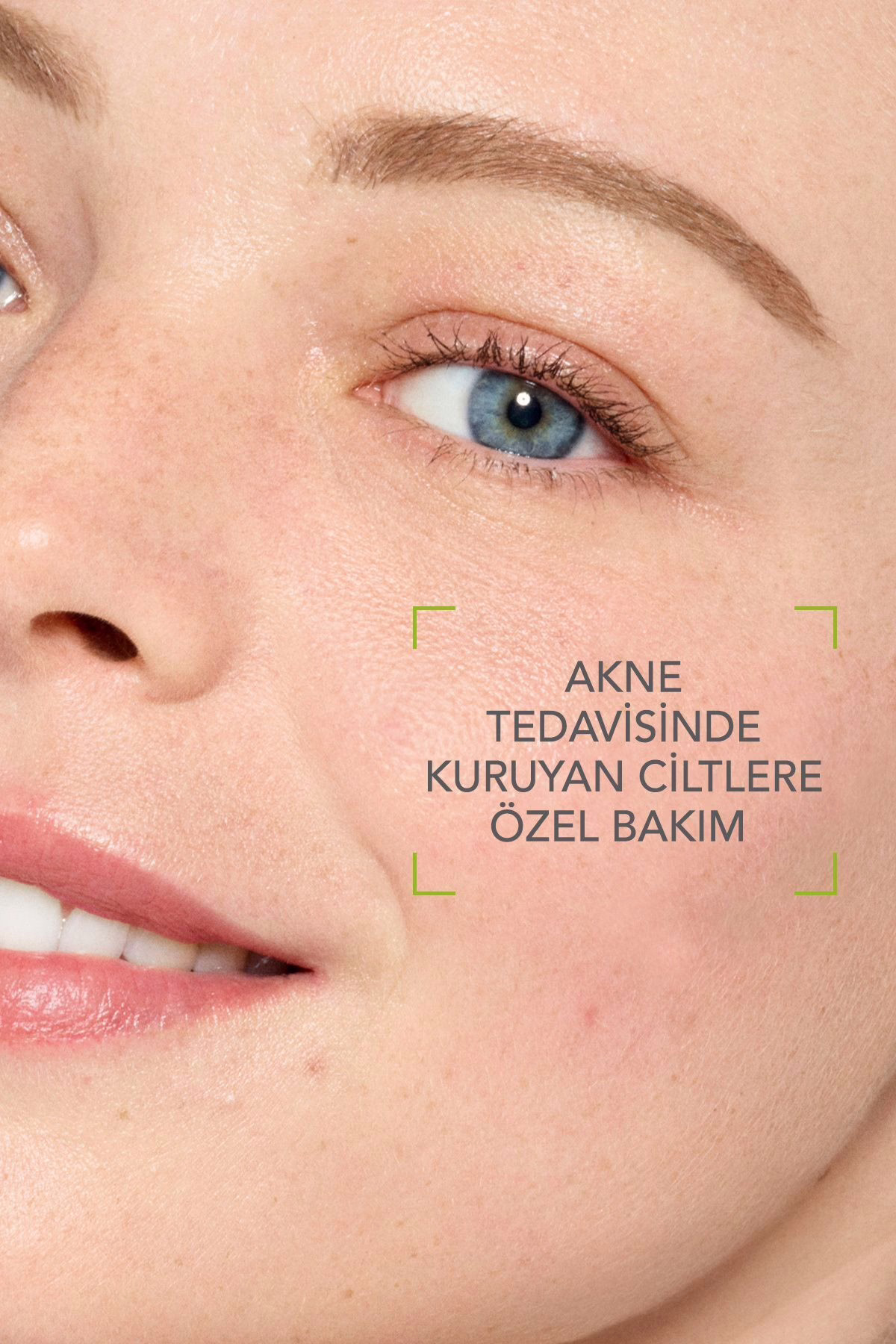 Bioderma Sebium Hydra 40 ml | Karma ve Yağlı Ciltler için Nemlendirici Krem 2 Bioderma Sebium Hydra 40 ml | Karma ve Yağlı Ciltler için Nemlendirici Krem