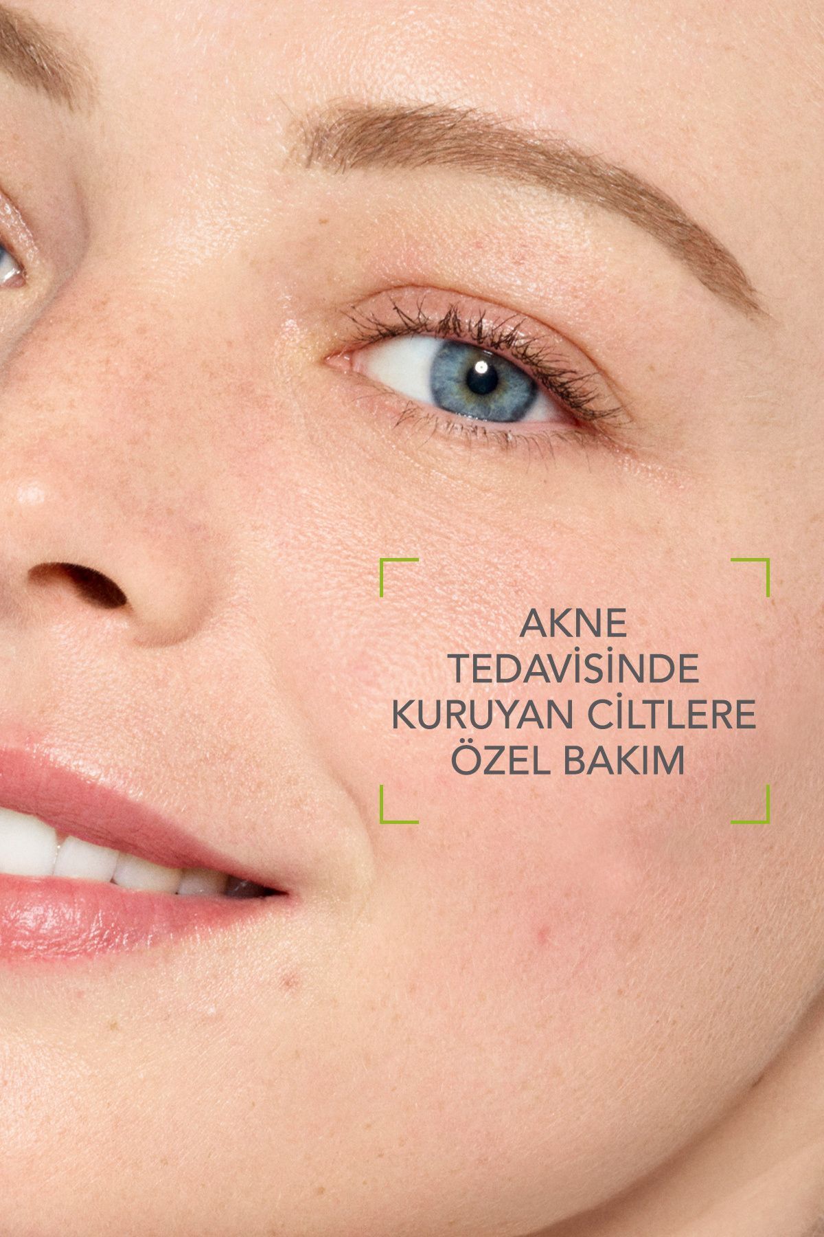 Bioderma Sebium Hydra 40 ml | Karma ve Yağlı Ciltler için Nemlendirici Krem 2 Bioderma Sebium Hydra 40 ml | Karma ve Yağlı Ciltler için Nemlendirici Krem