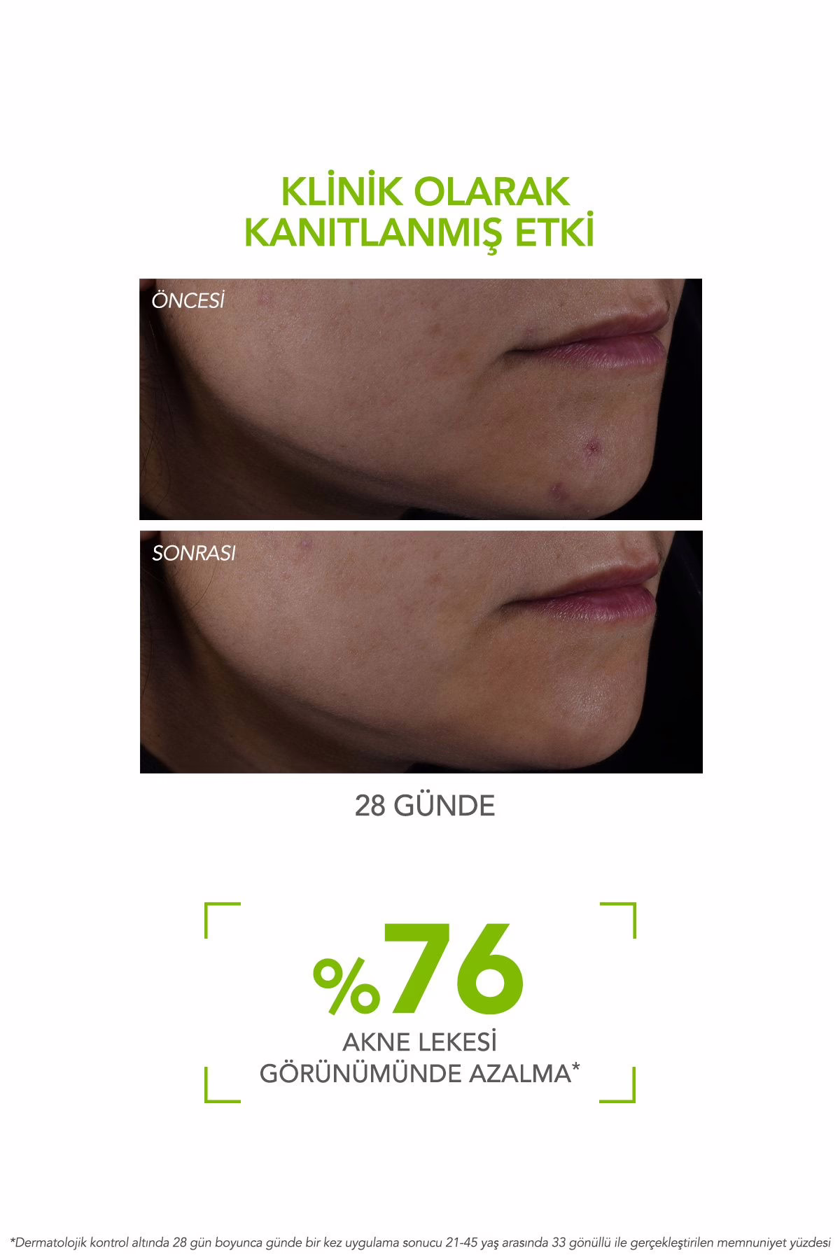 Sebium Serum 30 ml | Düzensiz Ciltler için Leke ve Gözenek Karşıtı Serum 3 Sebium Serum 30 ml | Düzensiz Ciltler için Leke ve Gözenek Karşıtı Serum