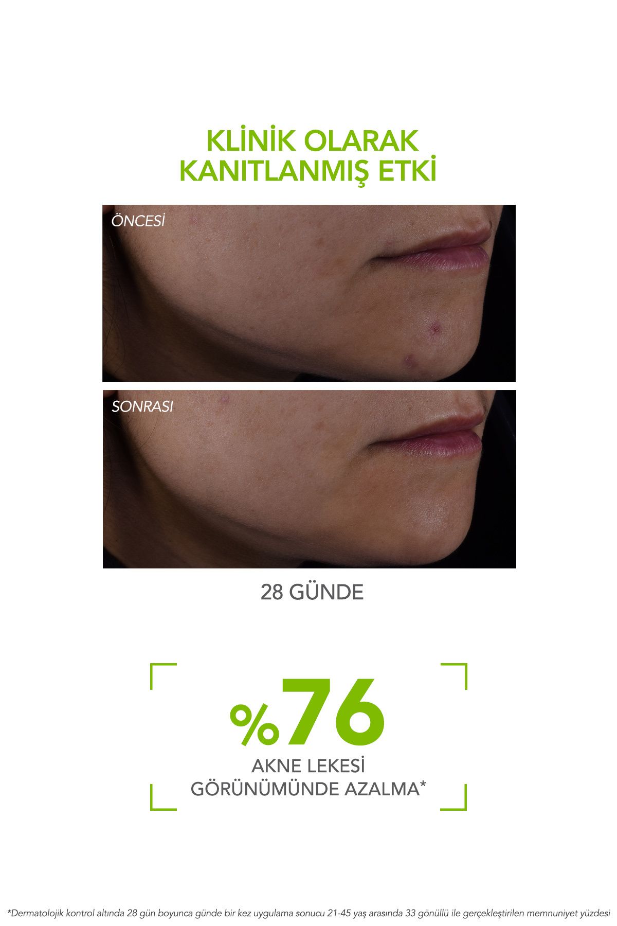 Sebium Serum 30 ml | Düzensiz Ciltler için Leke ve Gözenek Karşıtı Serum 3 Sebium Serum 30 ml | Düzensiz Ciltler için Leke ve Gözenek Karşıtı Serum