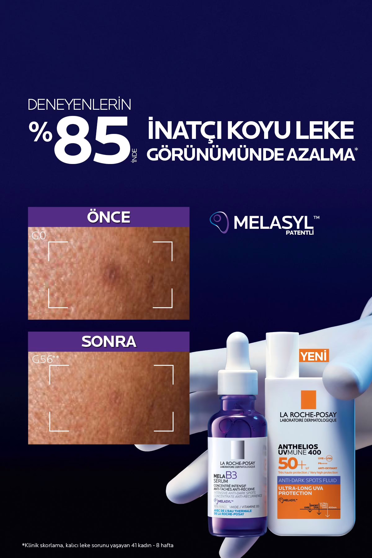Anthelios UVMune 400 Anti-Dark Spots Fluid SPF50+ 50 ml | Koyu Leke Yüz Güneş Kremi 2 Anthelios UVMune 400 Anti-Dark Spots Fluid SPF50+ 50 ml | Koyu Leke Yüz Güneş Kremi
