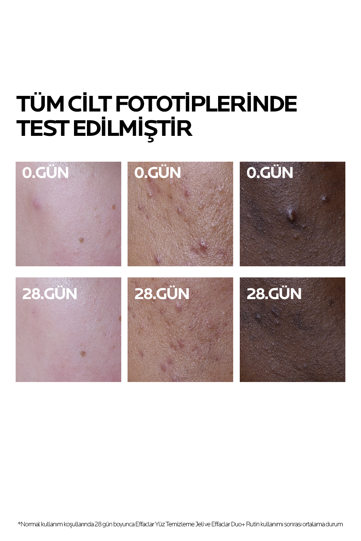 La Roche-Posay Effaclar Duo (+) 40 ml | Leke Görünümünü Destekleyici Krem 2 La Roche-Posay Effaclar Duo (+) 40 ml | Leke Görünümünü Destekleyici Krem