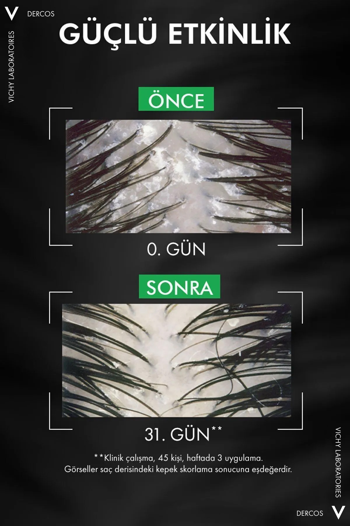 Dercos Anti Dandruff Normal ve Yağlı Saçlar İçin Kepek Karşıtı Şampuan 390 ml 4 Dercos Anti Dandruff Normal ve Yağlı Saçlar İçin Kepek Karşıtı Şampuan 390 ml - Görsel 4