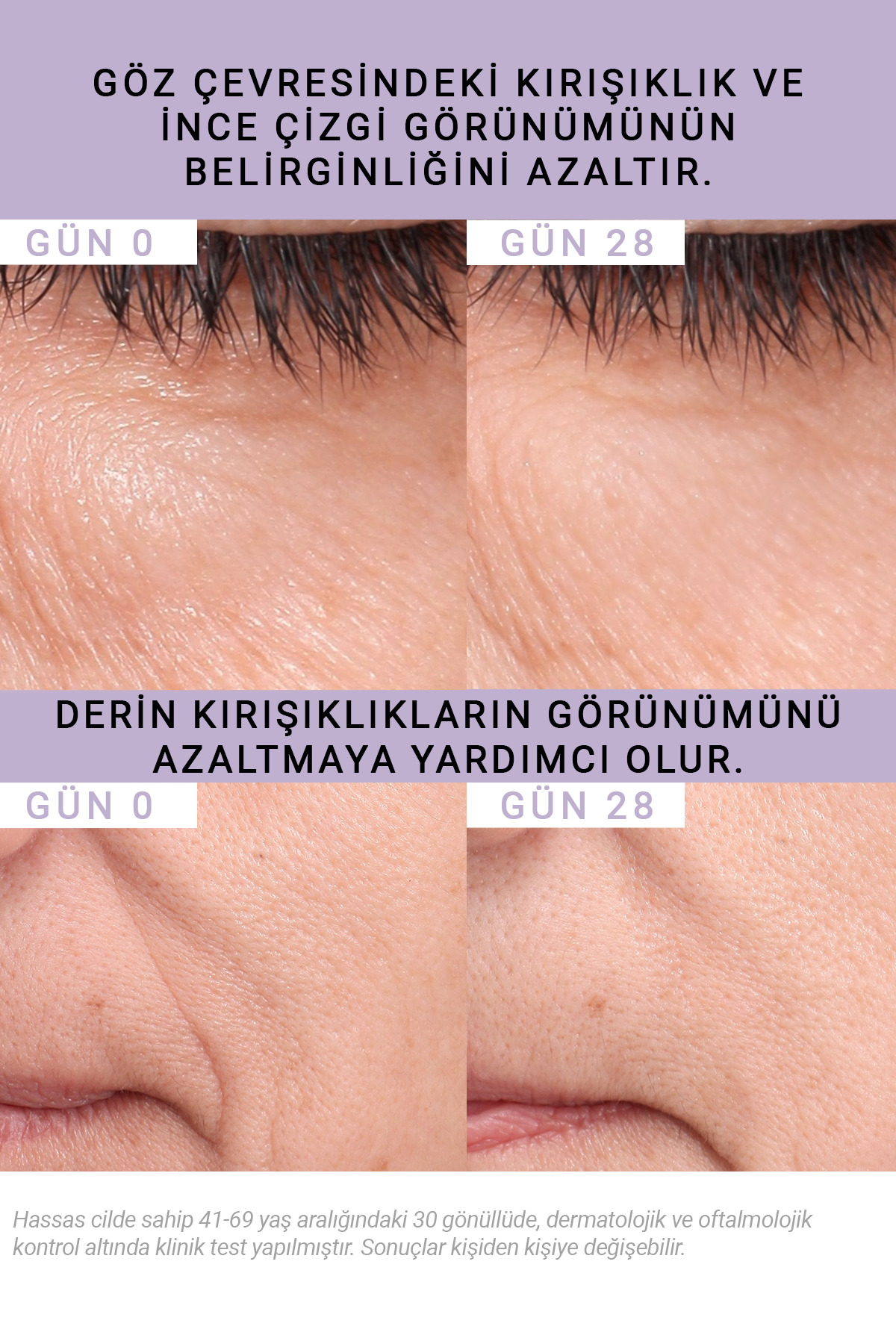 Bakuchiol %0,5 Kırışıklık Karşıtı Serum 15ML | Hassas Ciltler için Retinol Alternatifi 4 Bakuchiol %0,5 Kırışıklık Karşıtı Serum 15ML | Hassas Ciltler için Retinol Alternatifi - Görsel 4