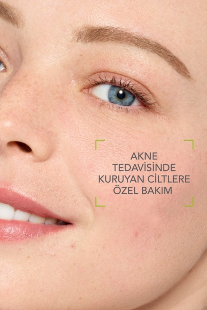 Sebium Hydra Yoğun Nemlendirici Seramid İçeren Kurutucu Akne Tedavisi Yatıştırıcı Bakım Kremi 40 ml - Görsel 2