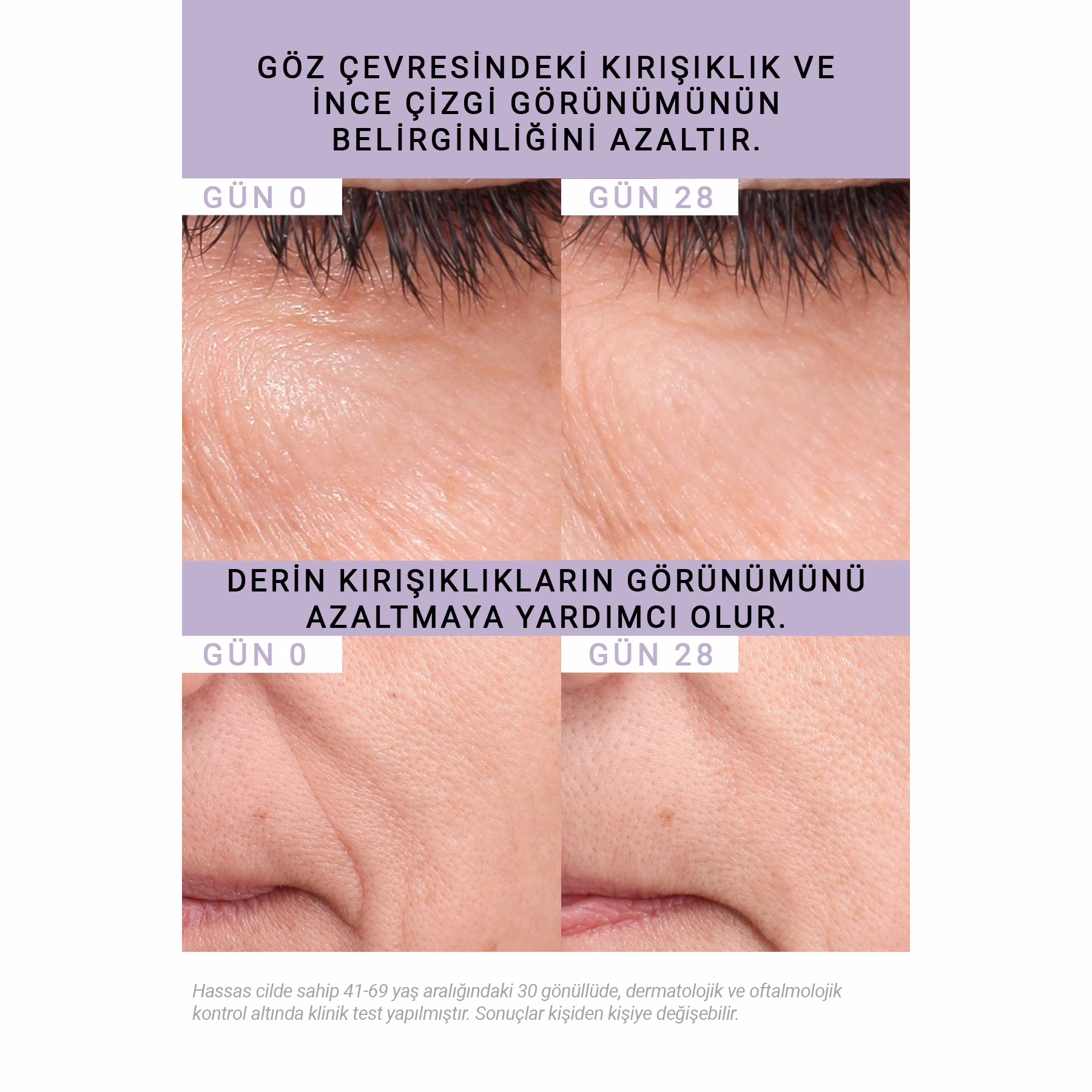 Bakuchiol %0,5 Kırışıklık Karşıtı Serum 15ML | Hassas Ciltler için Retinol Alternatifi